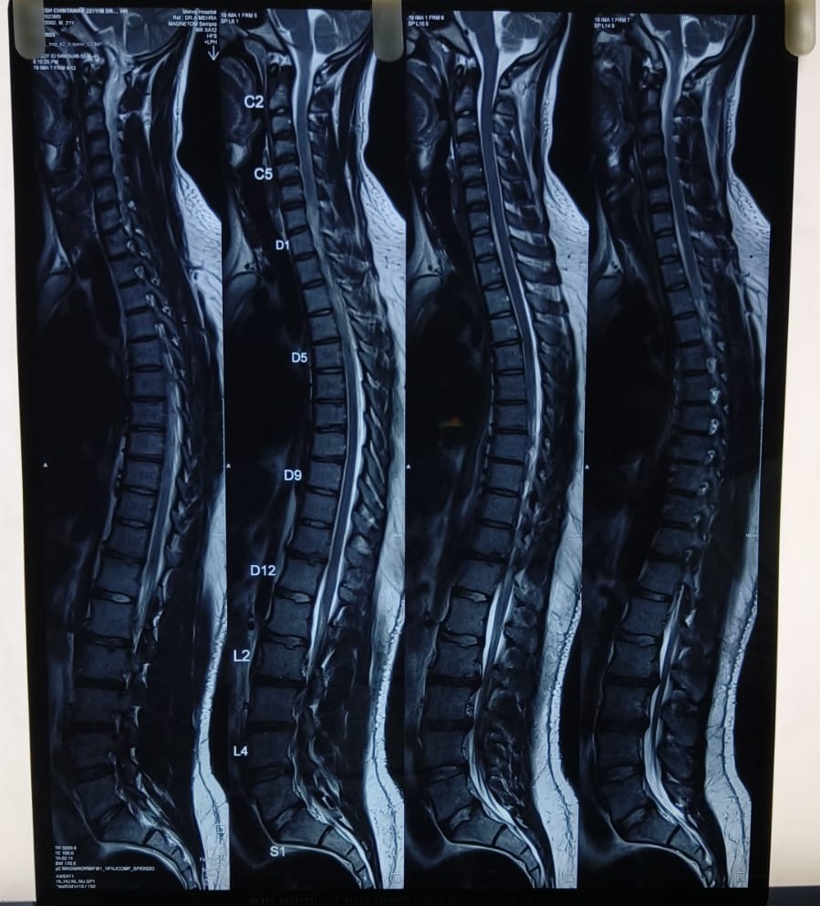 #Integritysuperspecialityhospital
#spinetreatment
... main image