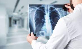 Comprehensive Spine Surgery at Kothrud Hospital, P... main image