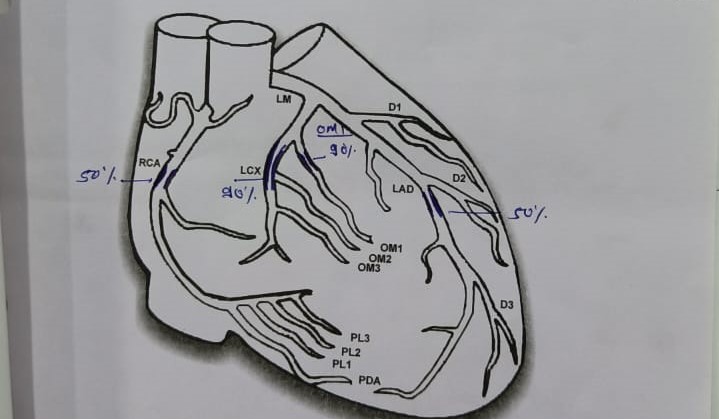 #Integritysuperspecialityhospital
#cardiactreatmen... main image