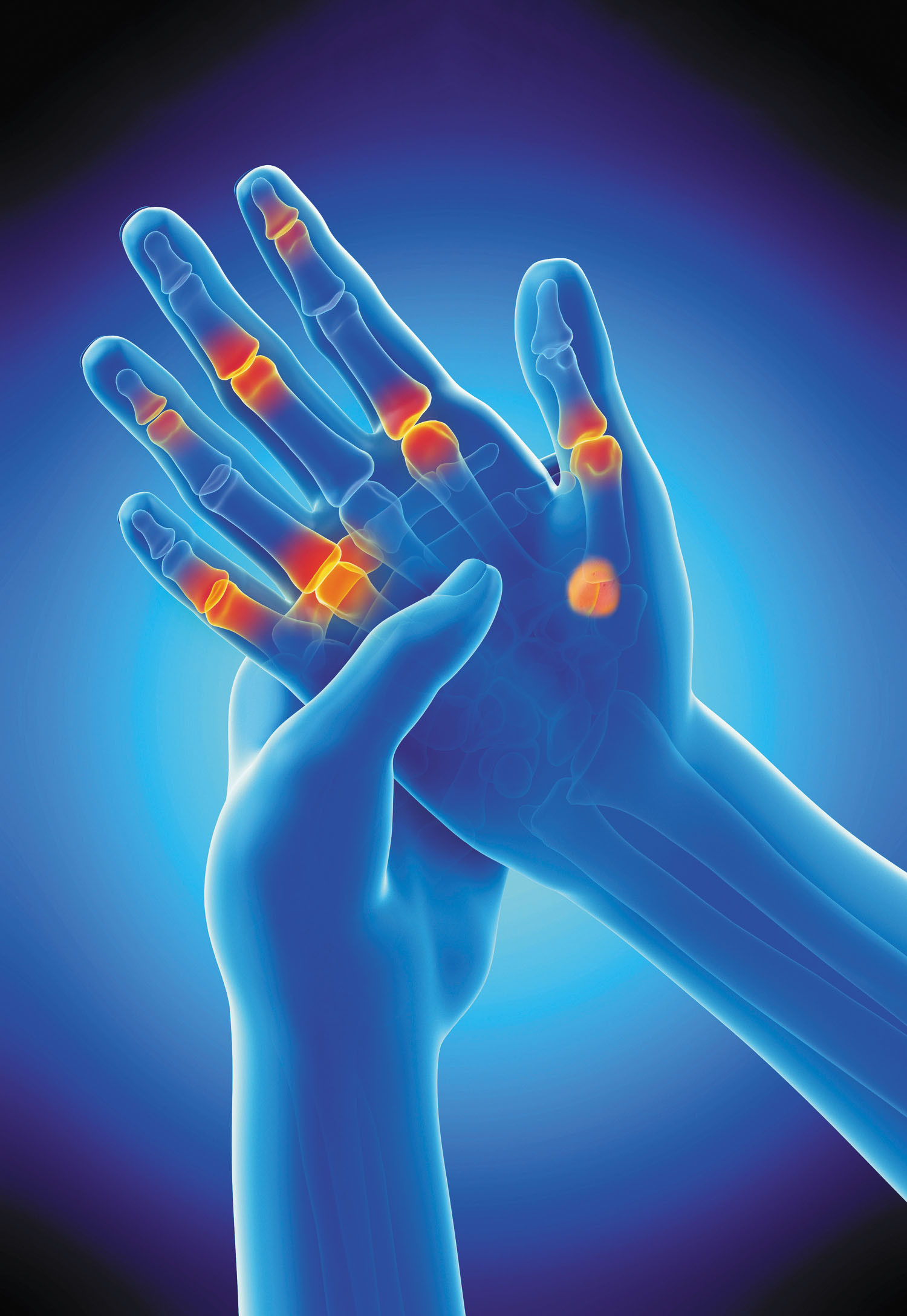 Advanced Hand Surgery: Restoring Function and D... main image