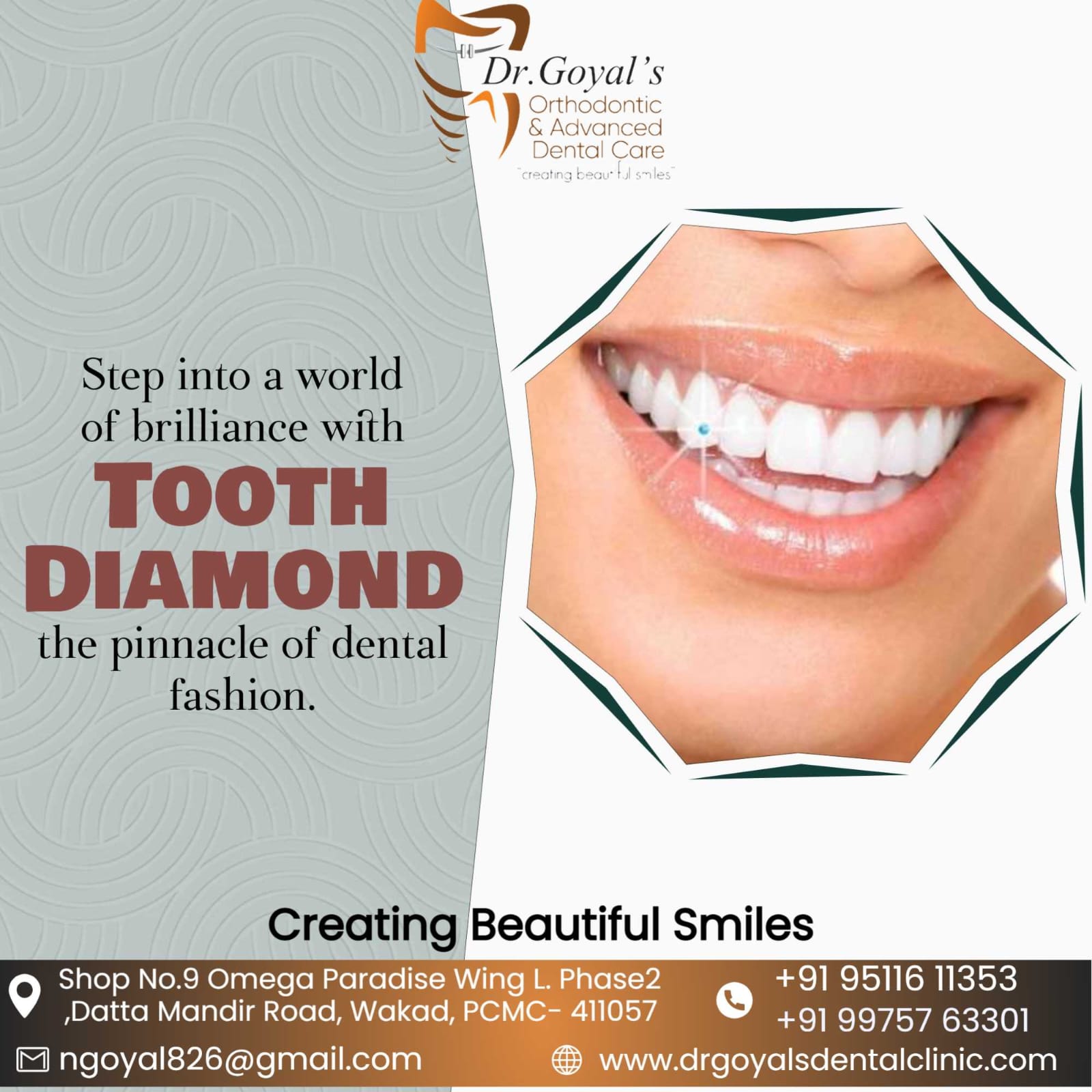 Tooth diamond is an accessory placed on the fro... main image