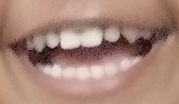 update image