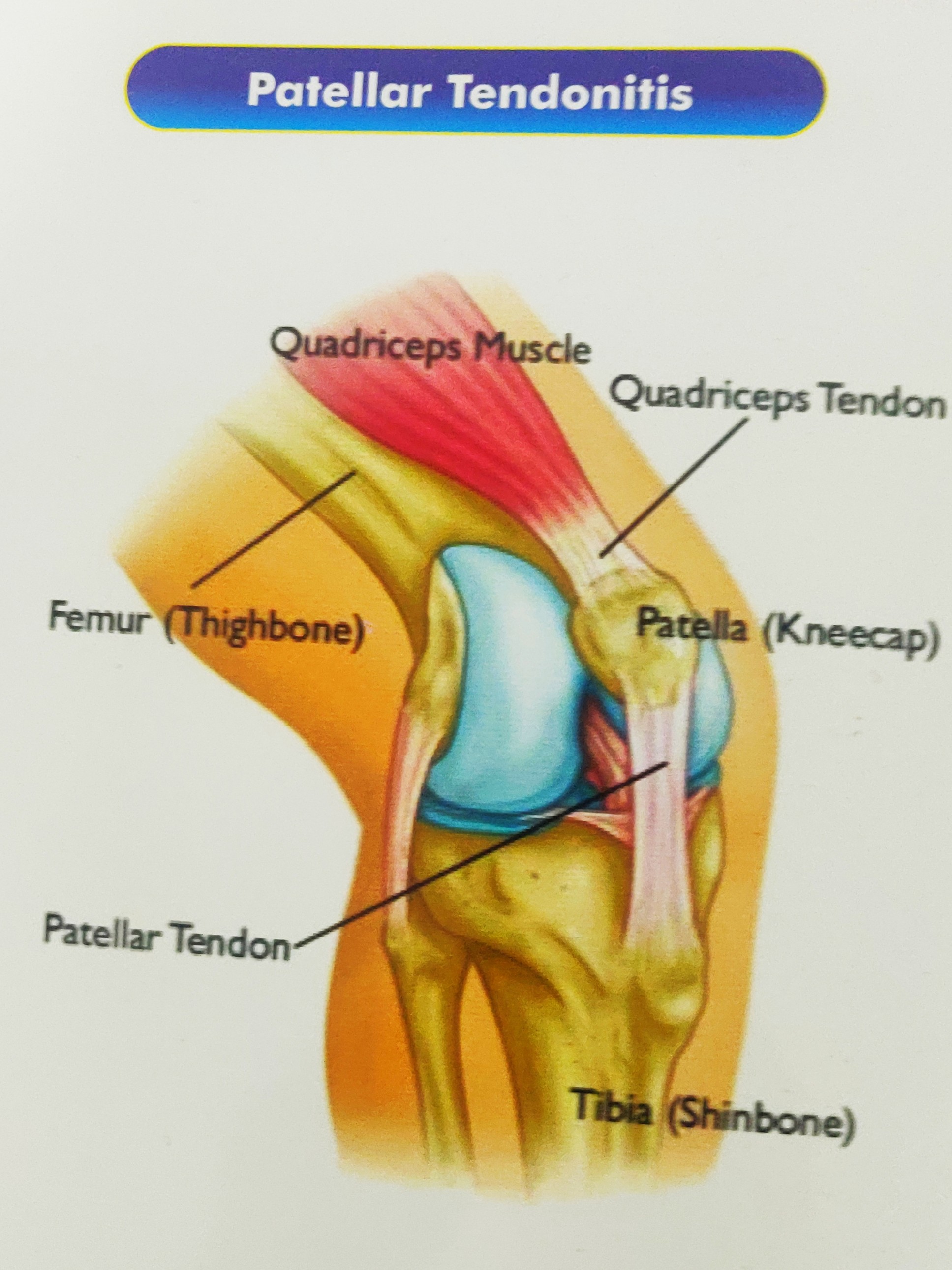 Best orthopedic surgeon in Pune 
Unity Hospital... main image
