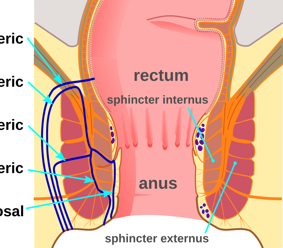 Fistula Surgery Options:-
 main surgical option... main image