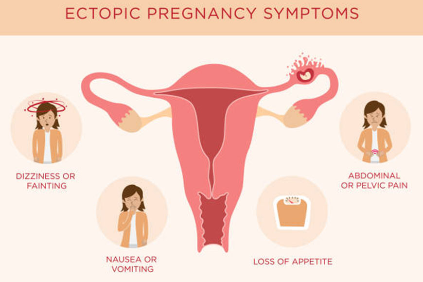 Ectopic Pregnancy Treatment Najafgarh

Looking ... main image