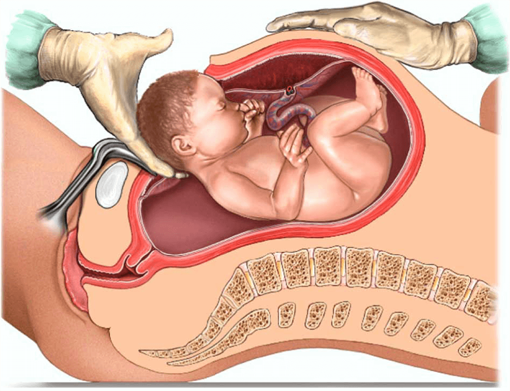 Caesarean Birth Delivery Najafgarh

Looking for... main image