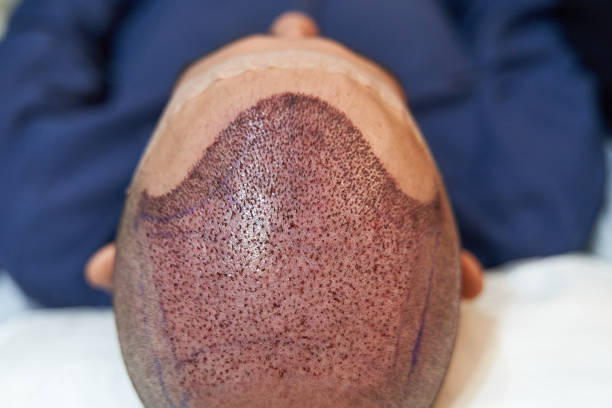 Medisky Multispeciality Clinic - Pioneering Hai... main image