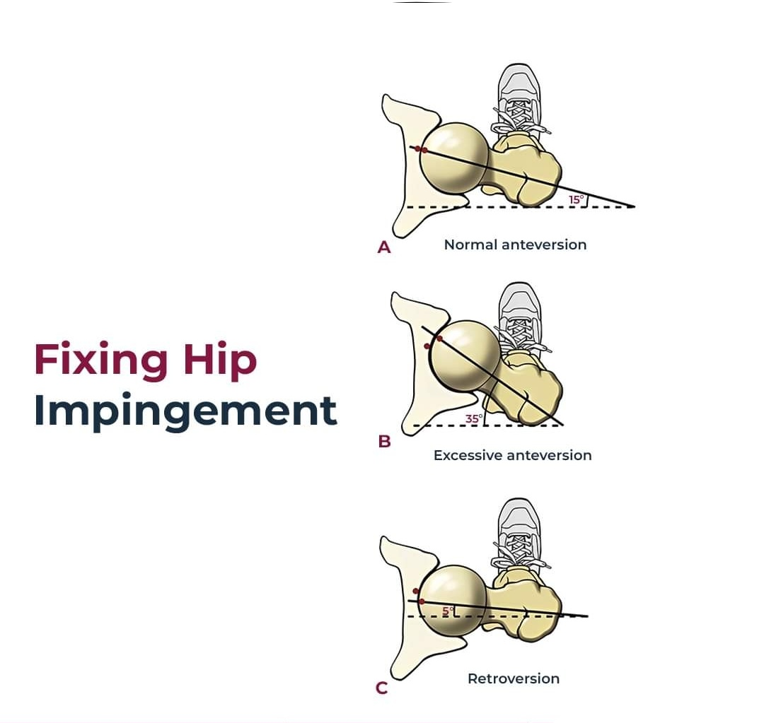 Physiotherapy clinic in Tambaram
Are you Looking f... main image