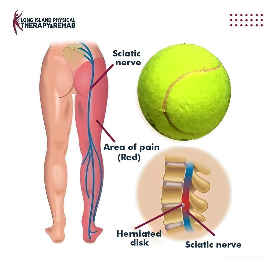 Physiotherapy clinic in Tambaram
Are you Looking f... main image