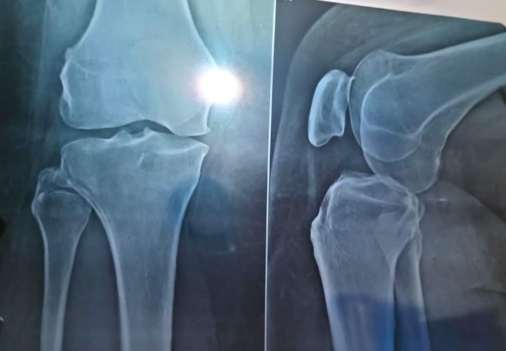 Physiotherapy clinic in Tambaram
Are you Looking f... main image
