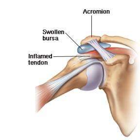 Physiotherapy clinic in Tambaram
Are you Looking f... main image