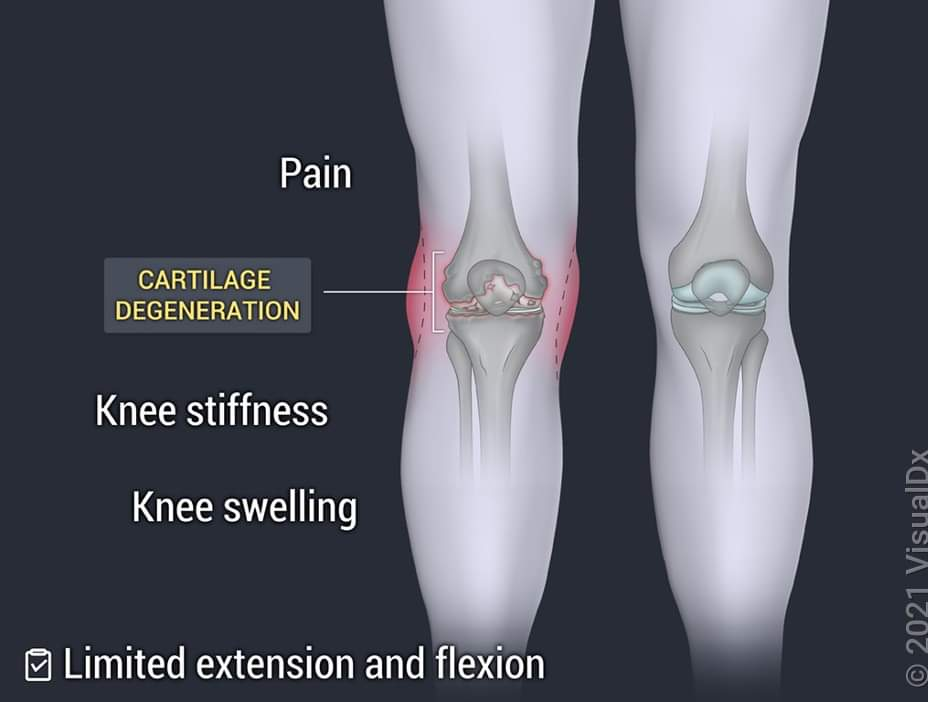Physiotherapy clinic in Tambaram
Are you Lookin... main image