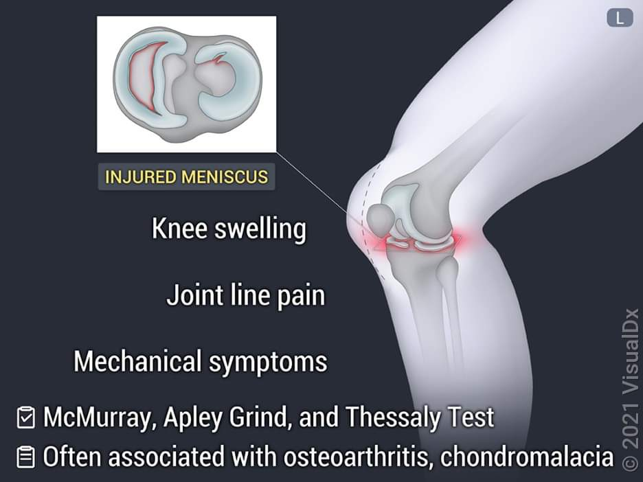 Physiotherapy clinic in Tambaram
Are you Looking f... main image