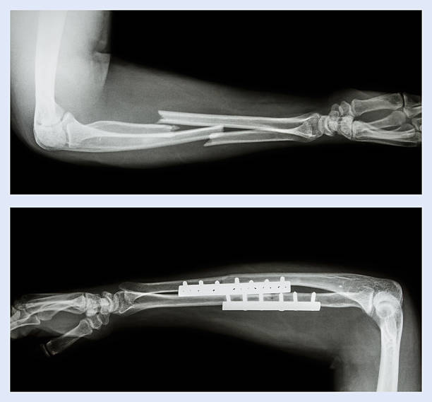 Advancements in Joint Replacement Surgery at Medin... main image
