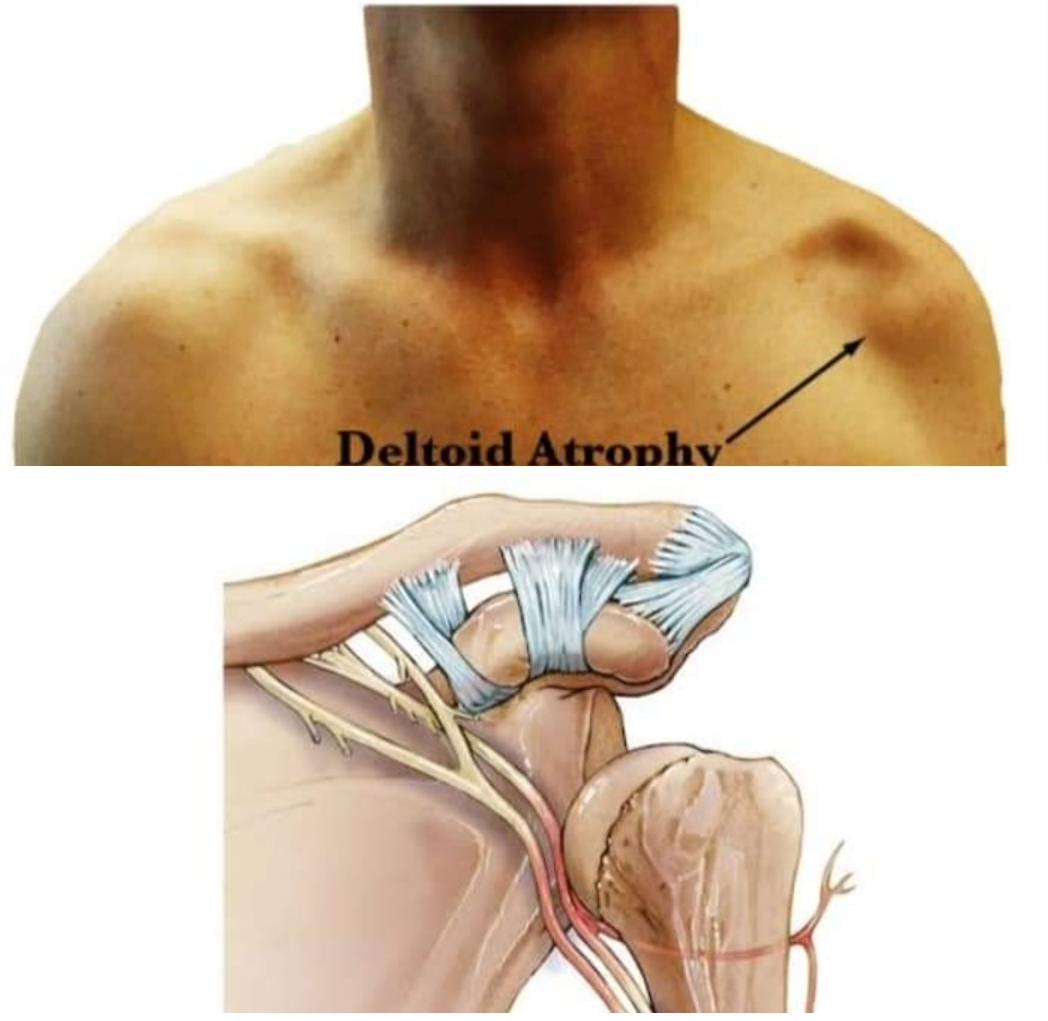 Physiotherapy clinic in Tambaram
Are you Looking f... main image
