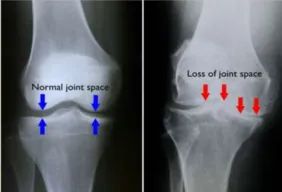 Physiotherapy clinic in Tambaram
Are you Looking f... main image