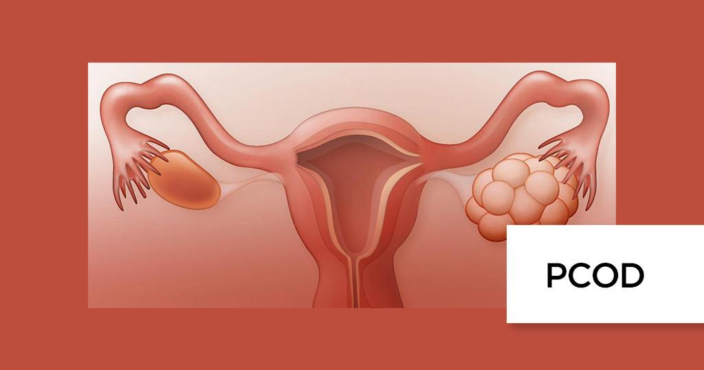 PCOD Treatment in Najafgarh

Pearl Gynae Clinic... main image