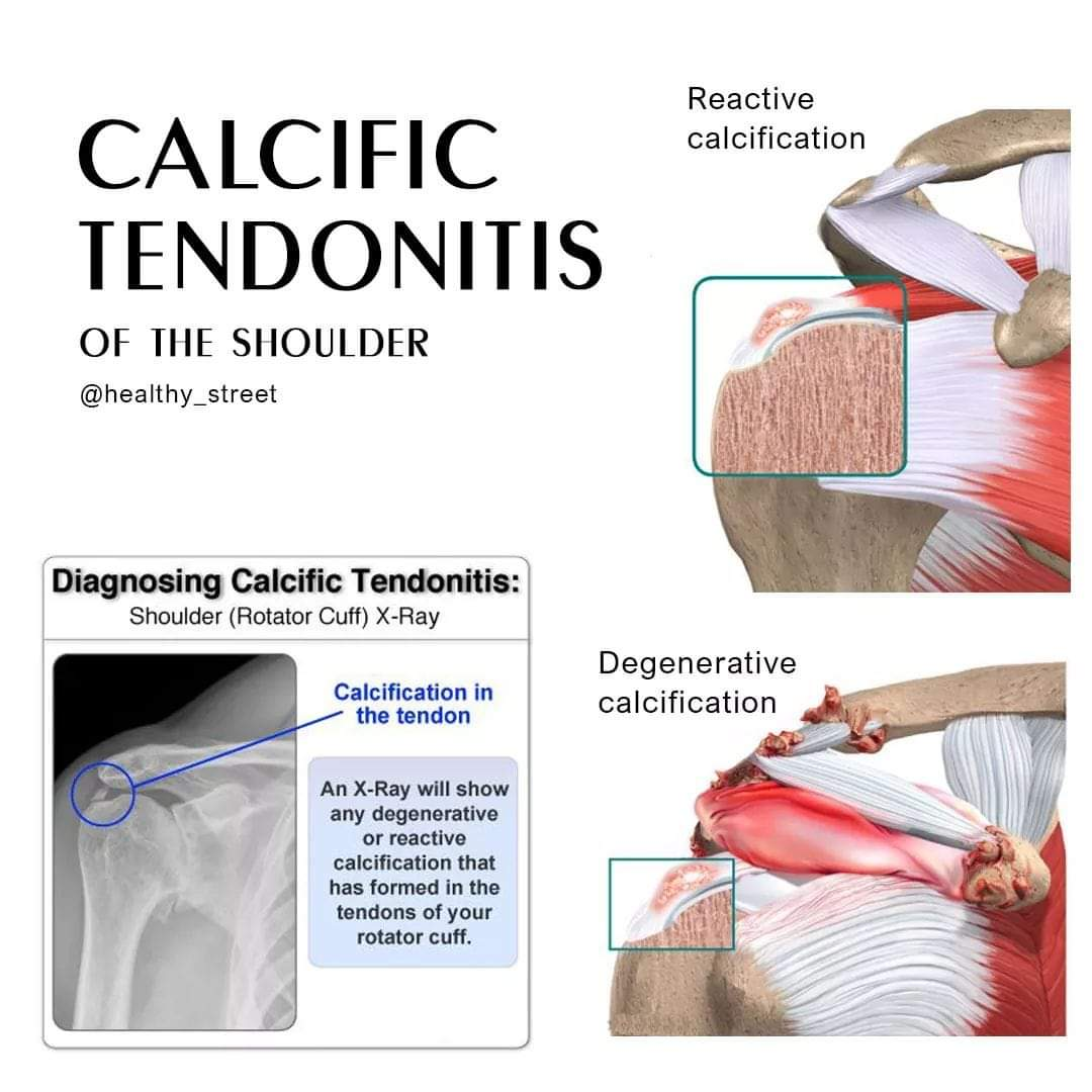 Physiotherapy clinic in Tambaram
Are you Lookin... main image