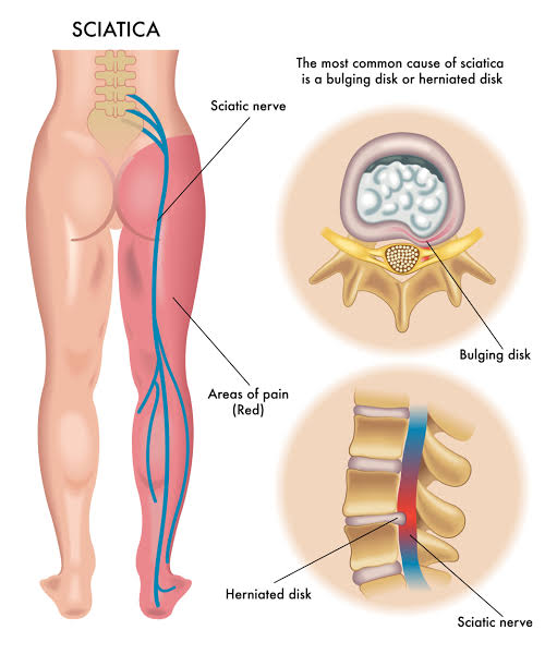 Physiotherapy clinic in Tambaram
Are you Looking f... main image