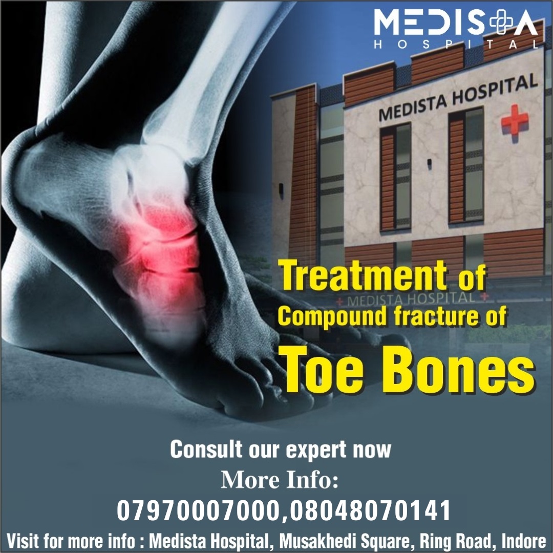 Best Compound Fracture of Toe Bones Treatment in I... main image