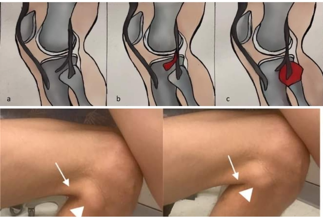 Physiotherapy clinic in Tambaram
Are you Looking f... main image