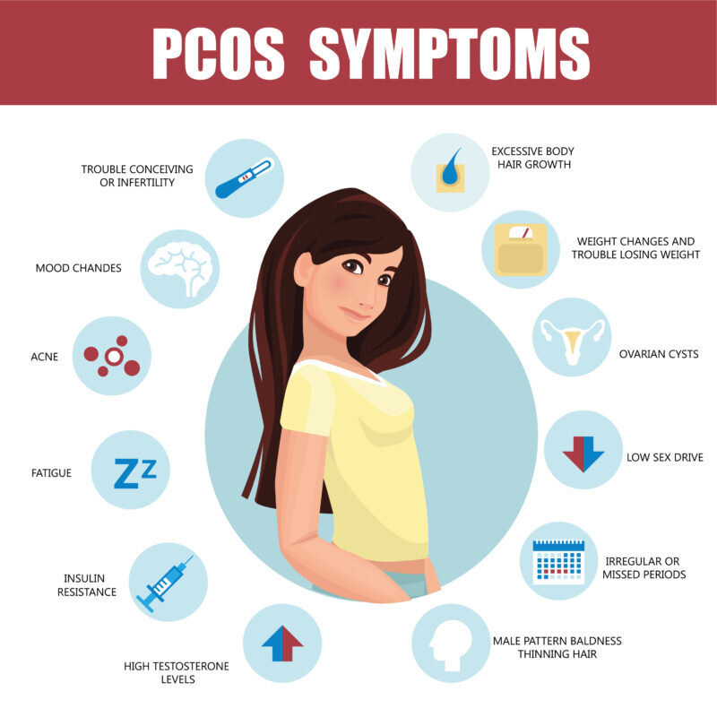 Polycystic ovary syndrome (PCOS), not to be con... main image