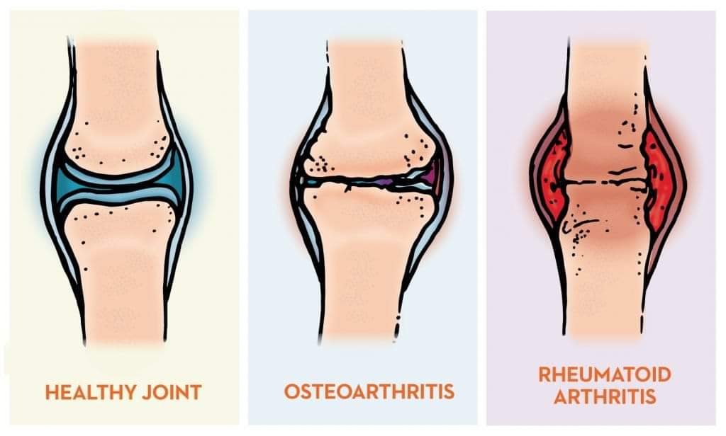 Physiotherapy clinic in Tambaram
Are you Looking f... main image
