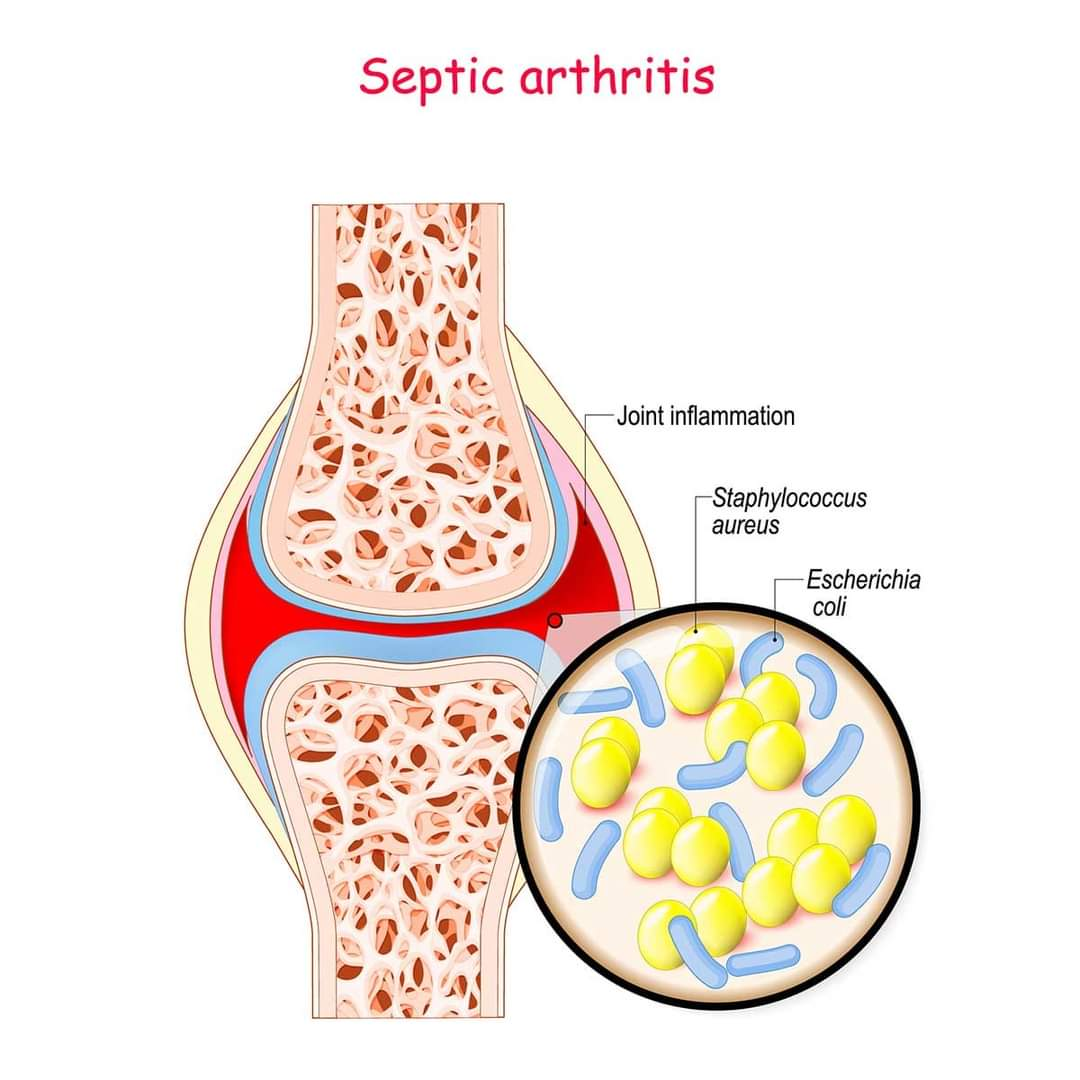 Physiotherapy clinic in Tambaram
Are you Looking f... main image