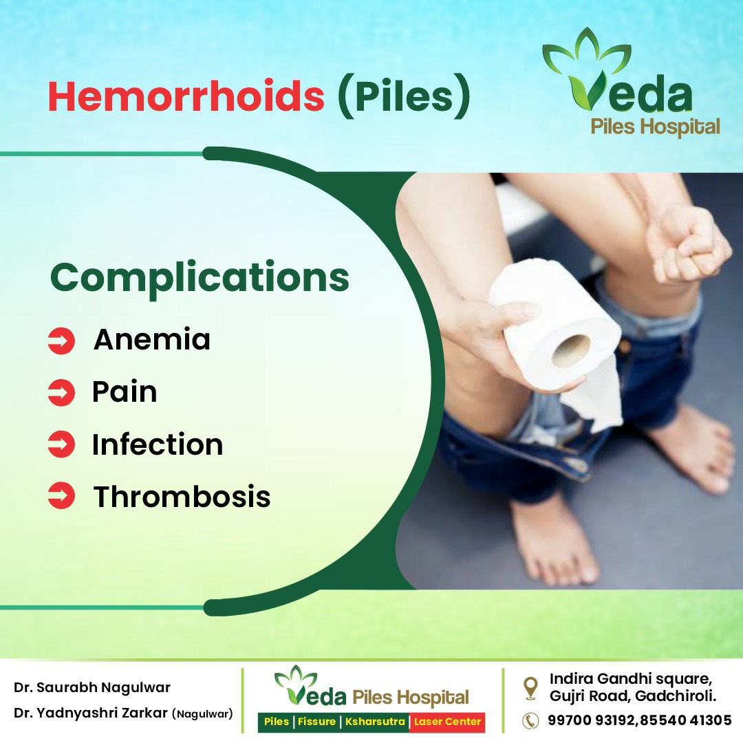 If you are experiencing hemorrhoids (piles), it... main image