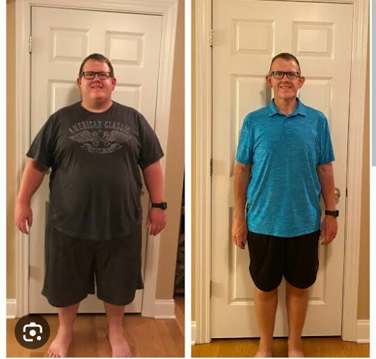 get best weight loss surgery treatment services... main image