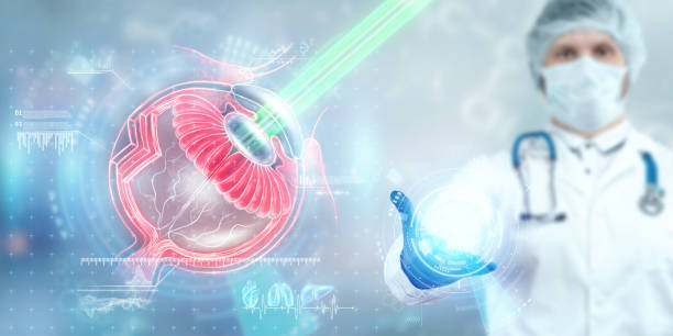 Lasik Laser Treatmen