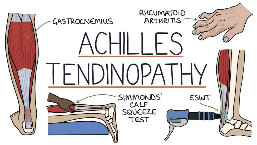 Physiotherapy clinic in Tambaram
Are you Looking f... main image
