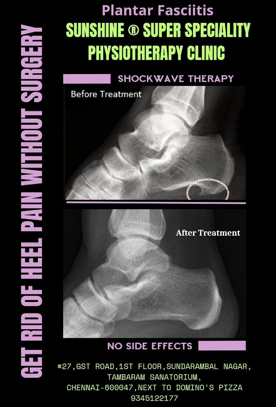 Physiotherapy clinic in Tambaram
Are you Looking f... main image
