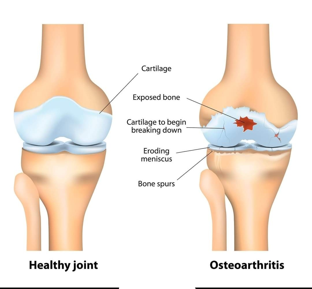 Physiotherapy clinic in Tambaram
Are you Looking f... main image