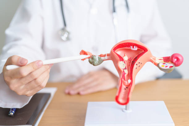 Gynecology Excellence in Chennai: Your Trusted Wom... main image
