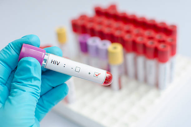 A Holistic Approach to HIV Treatment in Hyderab... main image
