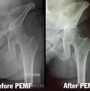 Physiotherapy clinic in Tambaram
Are you Lookin... main image