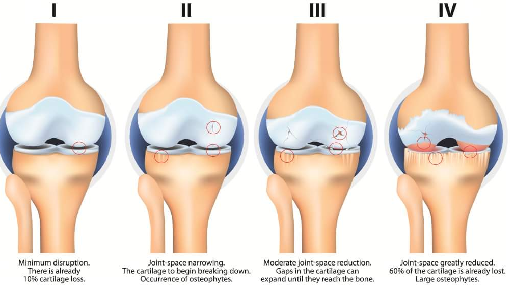 Physiotherapy clinic in Tambaram
Are you Looking f... main image
