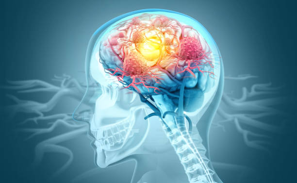 Neurosurgery - Precision and Care for Brain and Sp... main image