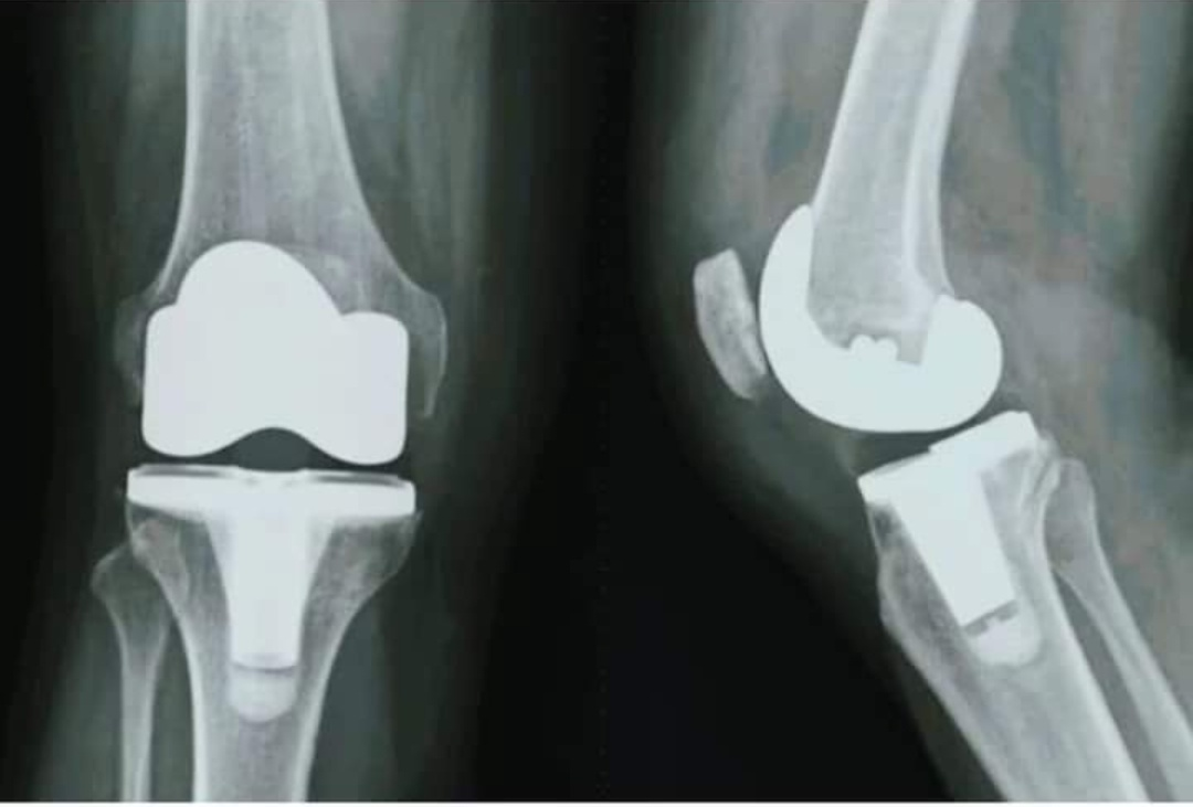 Physiotherapy clinic in Tambaram
Are you Looking f... main image