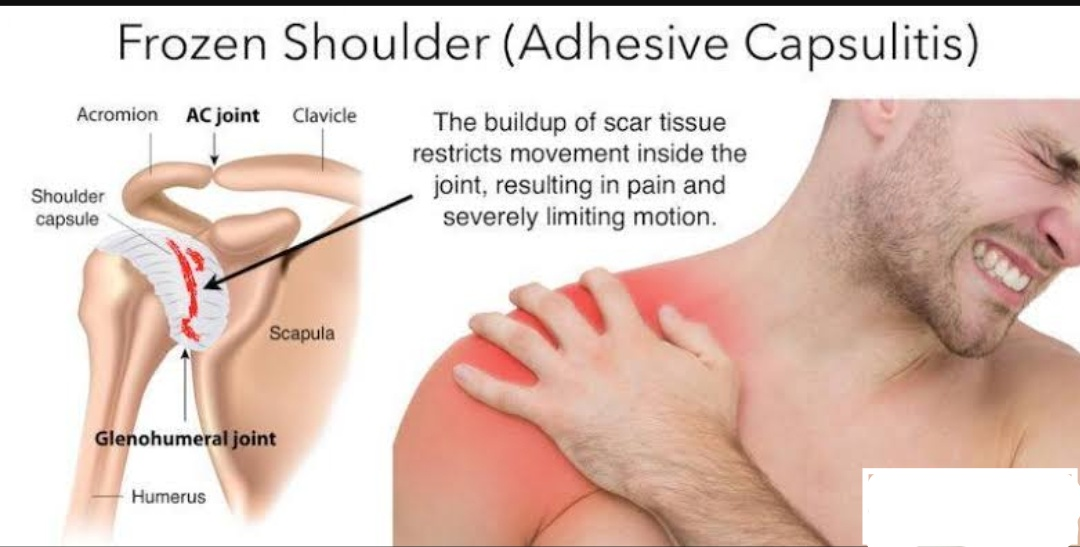 Physiotherapy clinic in Tambaram
Are you Lookin... main image
