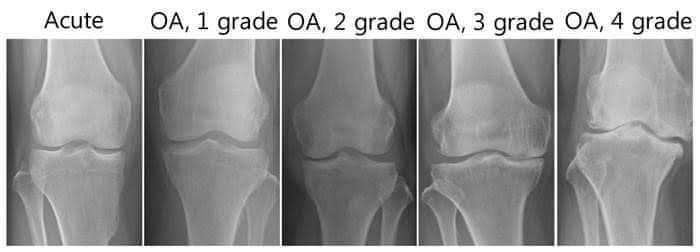 Physiotherapy clinic in Tambaram
Are you Looking f... main image
