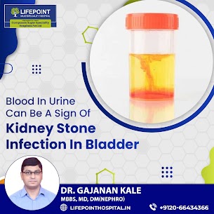 Best Urologist in Wakad Hinjewadi |
Blood in u... main image