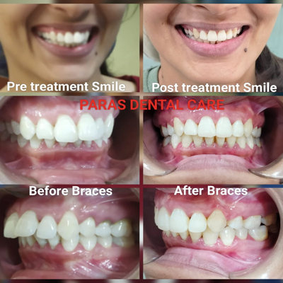 Patient came to our Dental clinic with a compla... main image