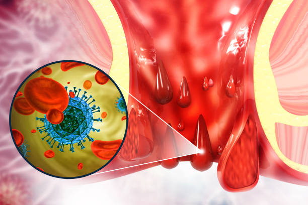 Comprehensive Guide to Piles Treatment at Dr. P... main image