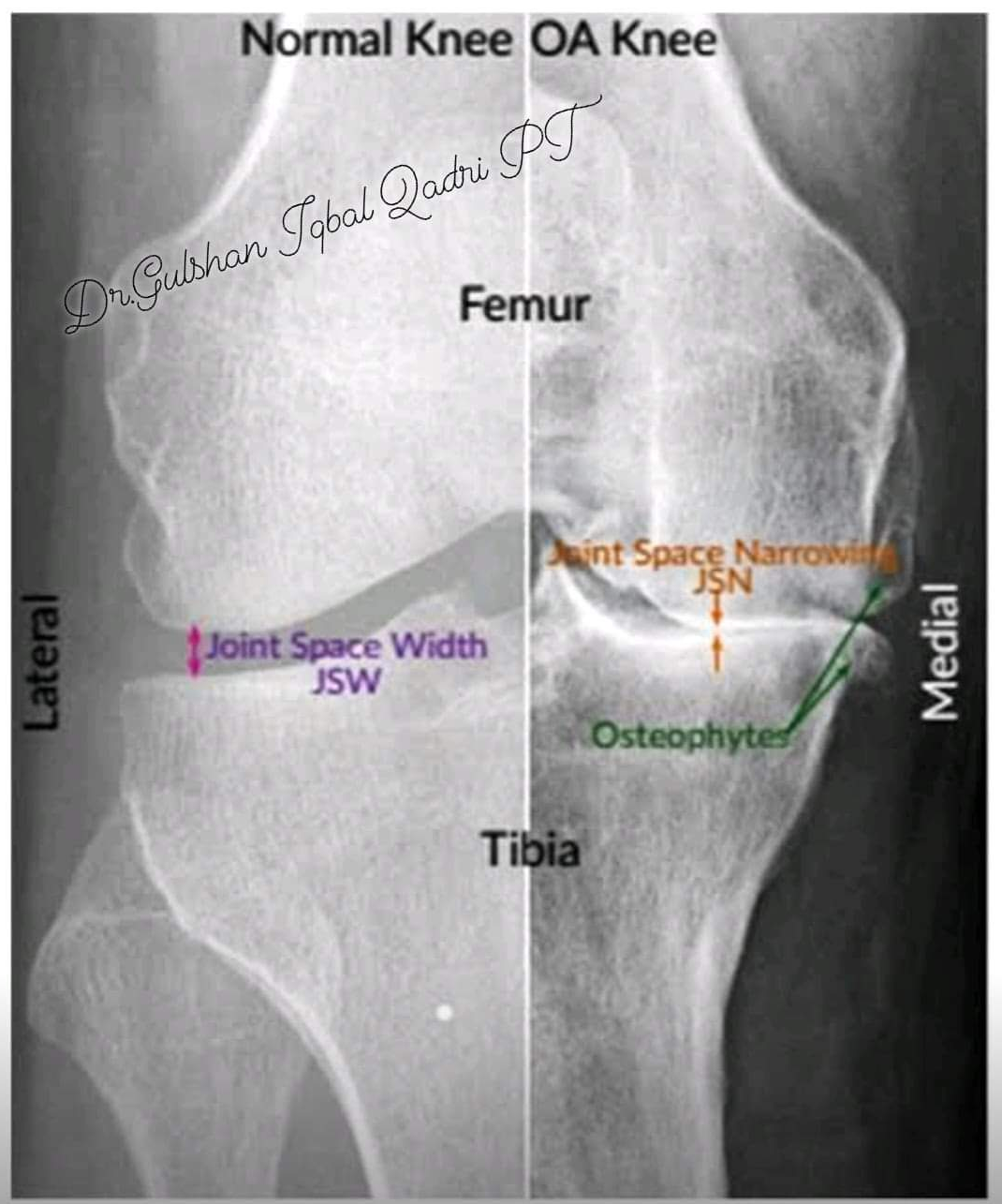 Physiotherapy clinic in Tambaram
Are you Looking f... main image