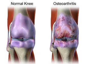 Physiotherapy clinic in Tambaram
Are you Lookin... main image