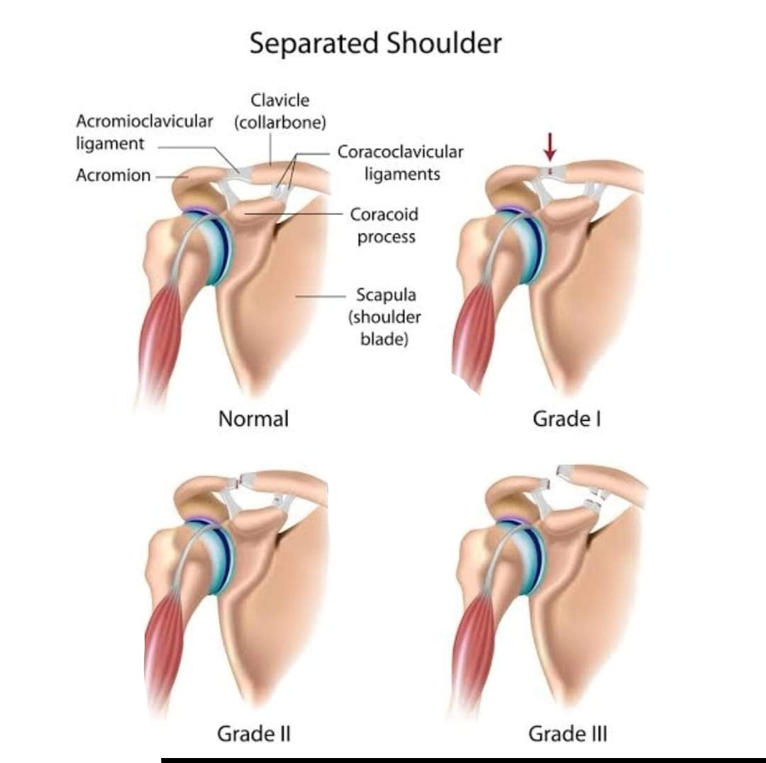 Physiotherapy clinic in Tambaram
Are you Looking f... main image