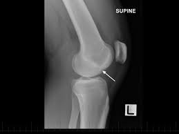 Physiotherapy clinic in Tambaram
Are you Looking f... main image