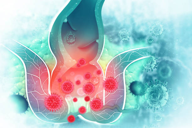 Comprehensive Guide to Piles Treatment at Dr. P... main image
